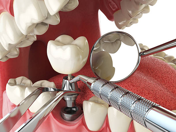 Best Walk-In Emergency Dentist in North Shore, CA